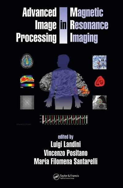 Advanced Image Processing in Magnetic Resonance Imaging