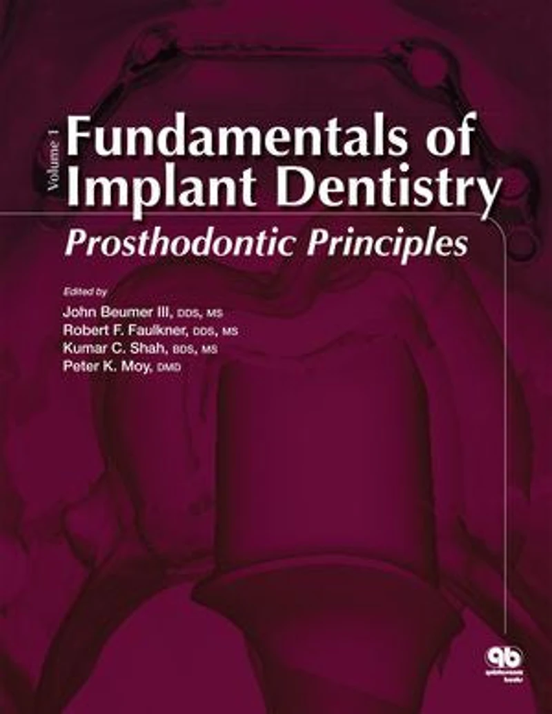 Fundamentals of Implant Dentistry: Prosthodontic Principles (Volume I)