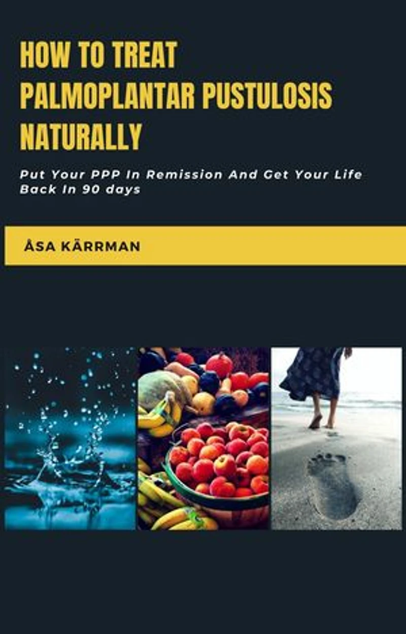 How To Treat Palmoplantar Pustulosis Naturally: Put Your PPP In Remission And Get Your Life Back in 90 days