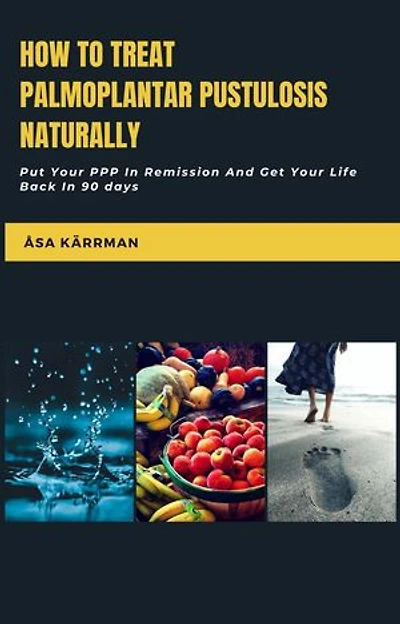 How To Treat Palmoplantar Pustulosis Naturally: Put Your PPP In Remission And Get Your Life Back in 90 days