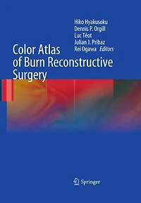Color Atlas of Burn Reconstructive Surgery