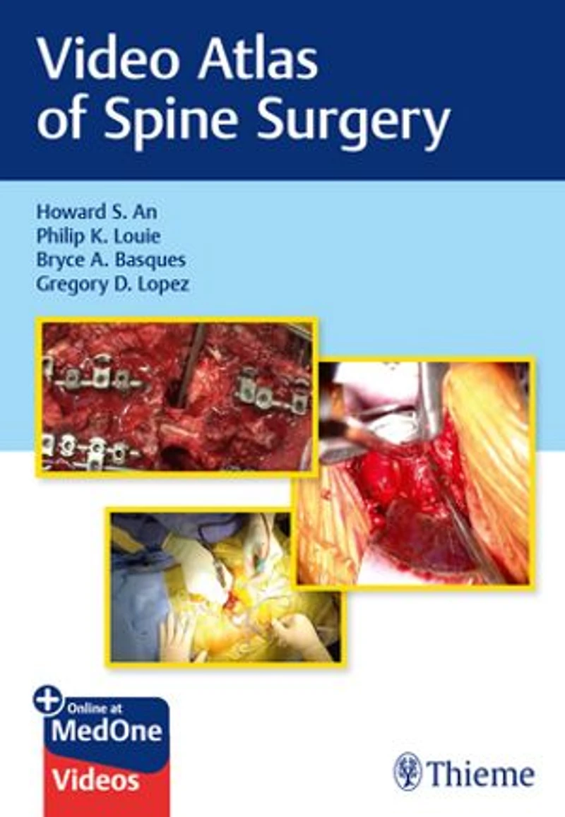 Video Atlas Of Spine Surgery