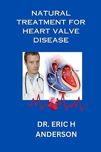NATURAL TREATMENT FOR HEART VALVE DISEASE: Effective Natural Approaches for Managing Heart Valve Disease
