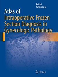 Atlas of Intraoperative Frozen Section Diagnosis Gynecologic Pathology