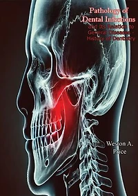Pathology of Dental Infections: and Its Relation to General Diseases - History of Dentistry