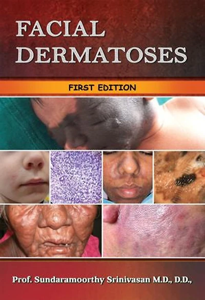 Facial Dermatoses