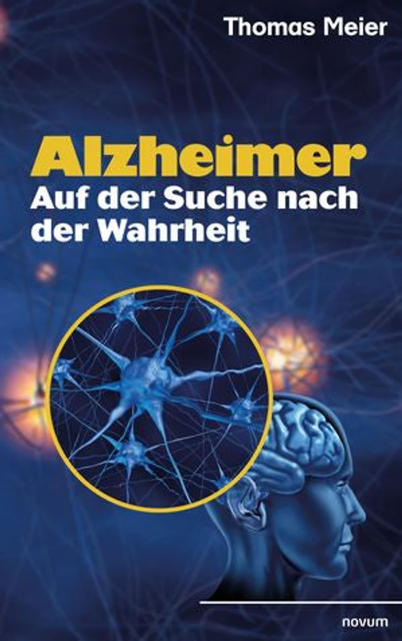 Alzheimer - search of the truth