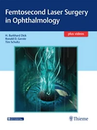 Femtosecond Laser Surgery Ophthalmology