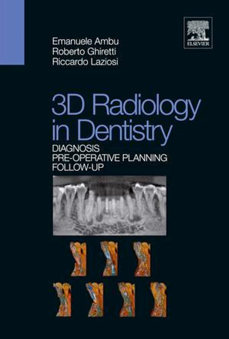3D Radiology Dentistry - Diagnosis Pre-Operative Planning Follow-Up