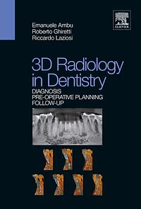 3D Radiology Dentistry - Diagnosis Pre-Operative Planning Follow-Up