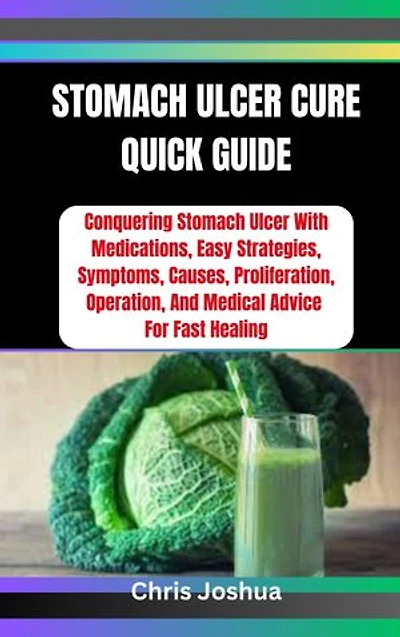 STOMACH ULCER CURE QUICK GUIDE: Conquering Stomach Ulcer With Medications, Easy Strategies, Symptoms, Causes, Proliferation, Operation, And Medical Advice For Fast Healing