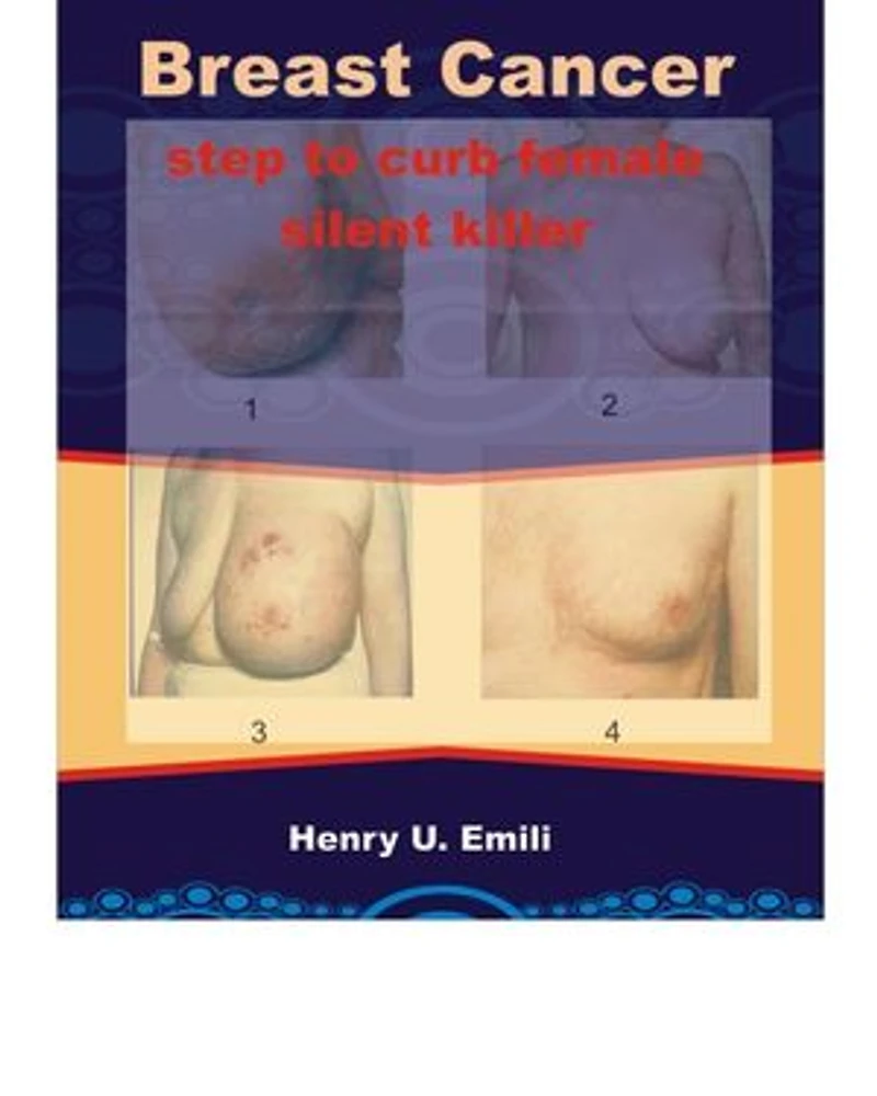 Breast Cancer: Step to curb female silent killer
