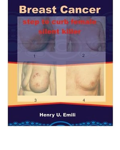 Breast Cancer: Step to curb female silent killer