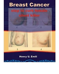 Breast Cancer: Step to curb female silent killer