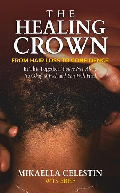 The Healing Crown: From Hair Loss to Confidence
