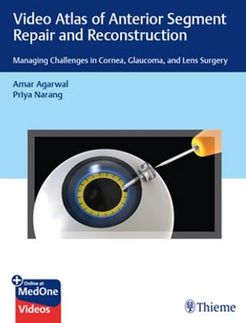 Video Atlas Of Anterior Segment Repair And Reconstruction: Managing Challenges Cornea, Glaucoma, Lens Surgery