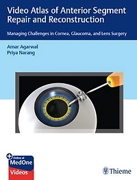 Video Atlas Of Anterior Segment Repair And Reconstruction: Managing Challenges Cornea, Glaucoma, Lens Surgery