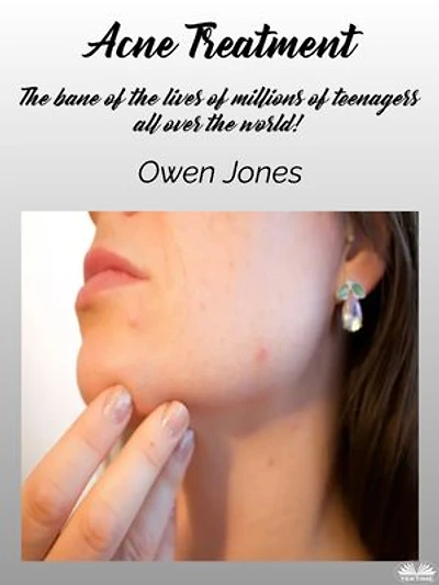 Acne Treatment: The bane of the lives of millions of teenagers all over the world!