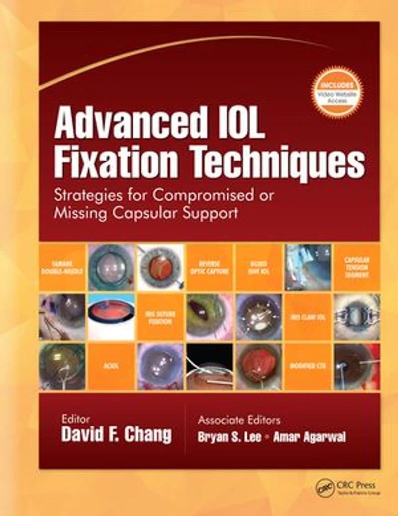 Advanced IOL Fixation Techniques: Strategies for Compromised or Missing Capsular Support