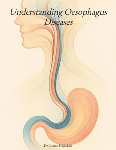 Understanding Oesophagus Diseases: Understanding Medicine