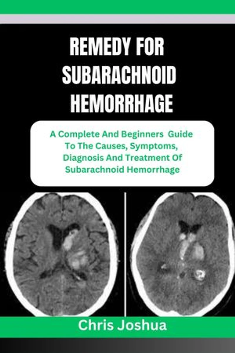 REMEDY FOR SUBARACHNOID HEMORRHAGE: A Complete And Beginners Guide To The Causes, Symptoms, Diagnosis And Treatment Of Subarachnoid Hemorrhage