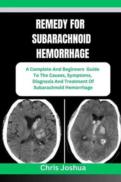 REMEDY FOR SUBARACHNOID HEMORRHAGE: A Complete And Beginners Guide To The Causes, Symptoms, Diagnosis And Treatment Of Subarachnoid Hemorrhage