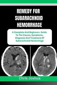 REMEDY FOR SUBARACHNOID HEMORRHAGE: A Complete And Beginners Guide To The Causes, Symptoms, Diagnosis And Treatment Of Subarachnoid Hemorrhage
