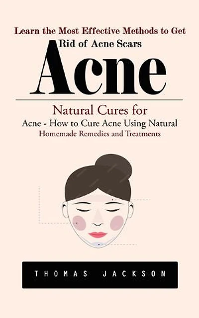 Acne: Learn the Most Effective Methods to Get Rid of Acne Scars (Natural Cures for Acne - How to Cure Acne Using Natural Homemade Remedies and Treatments)