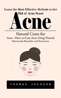 Acne: Learn the Most Effective Methods to Get Rid of Acne Scars (Natural Cures for Acne - How to Cure Acne Using Natural Homemade Remedies and Treatments)