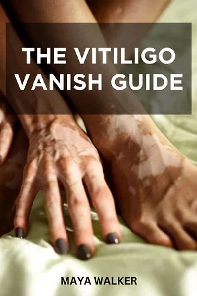 THE VITILIGO VANISH GUIDE: Essential Guide On Skin Pigmentation Improvement And Treating Vitiligo