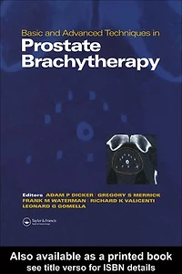 Basic and Advanced Techniques in Prostate Brachytherapy