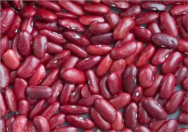 The Truth About Dealing With Kidney Stones : The Tips and Tricks