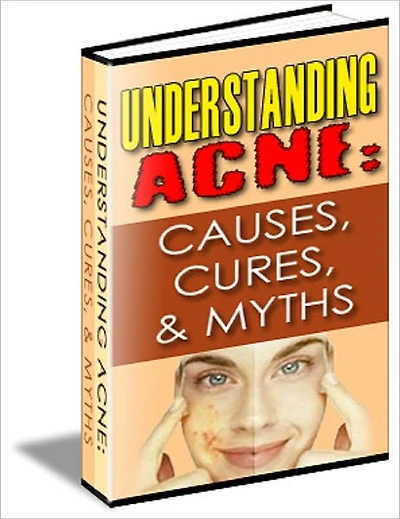 Understanding Acne: Causes, Cures and Myths