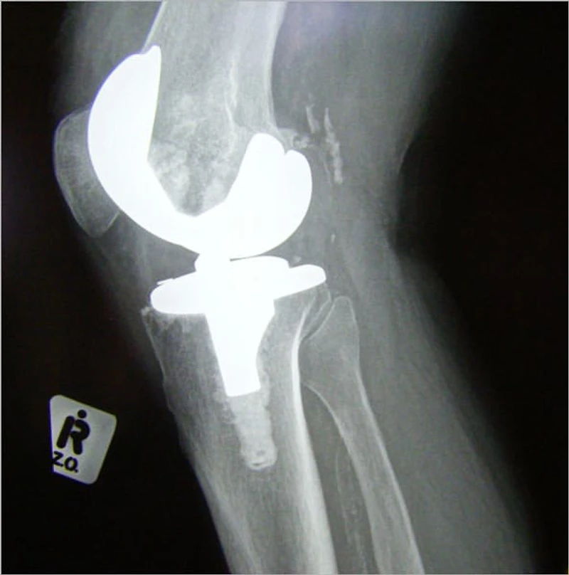 The Truth about Managing Arthritis Pain: A Personal Action Plan for Coping with Joint Pain