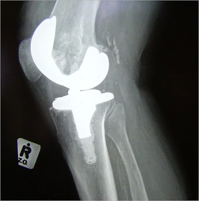 The Truth about Managing Arthritis Pain: A Personal Action Plan for Coping with Joint Pain