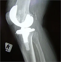 The Truth about Managing Arthritis Pain: A Personal Action Plan for Coping with Joint Pain