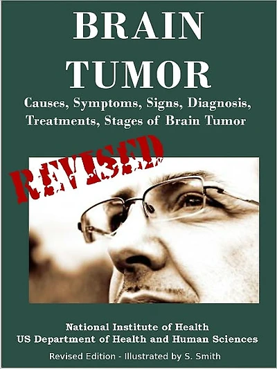 BRAIN TUMOR: Causes, Symptoms, Signs, Diagnosis, Treatments, Stages of Brain Tumor - Revised Edition - Illustrated by S. Smith