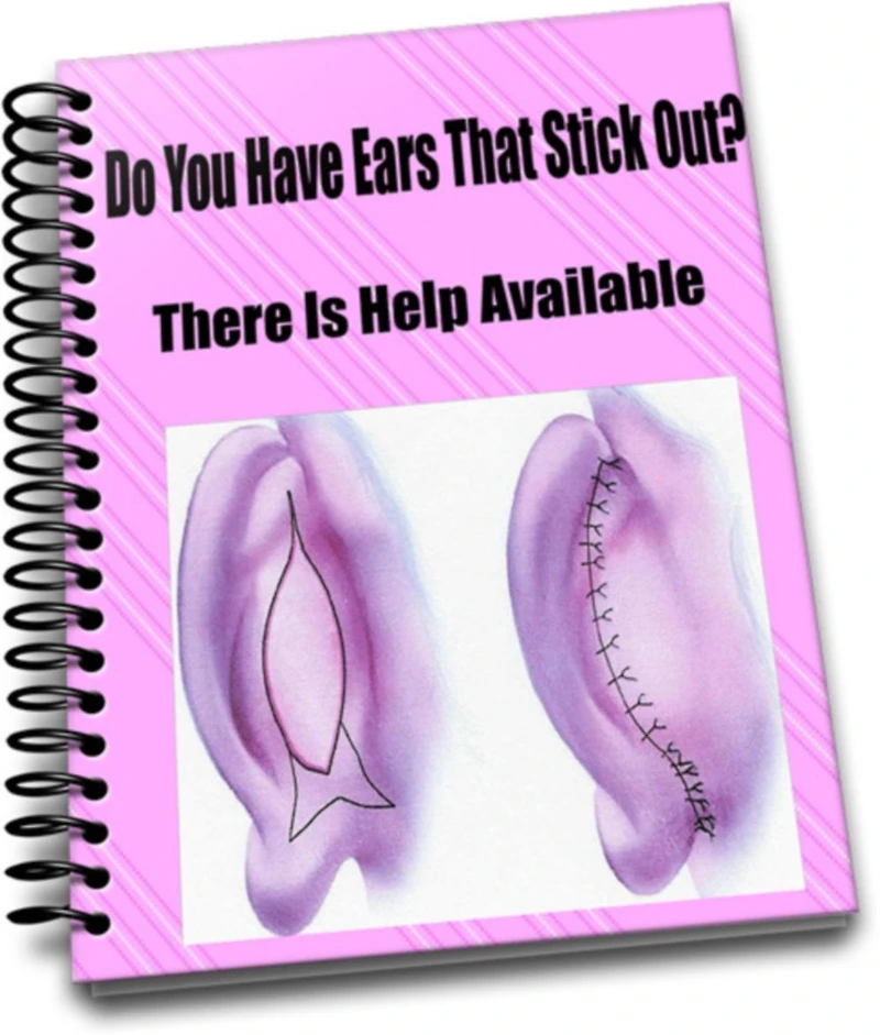 Do You Have Ears That Stick Out-There Is Help Available
