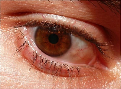 How to Prevent Glaucoma: Foods that Can Prevent Glaucoma and Boost Your Eyes Health