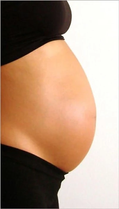 40 Ways to Get Rid of or Prevent Stretch Marks