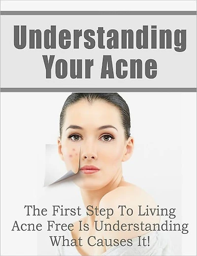 Understanding Your Acne