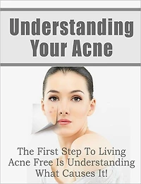 Understanding Your Acne