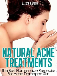 Natural Acne Treatments
