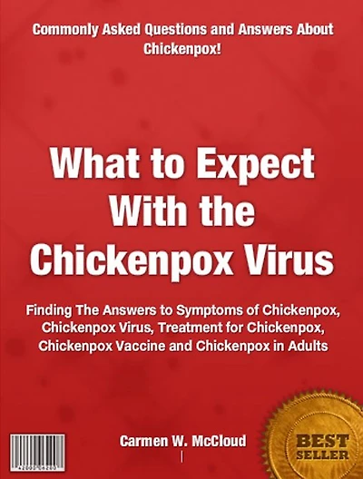 What to Expect With the Chickenpox Virus: Finding The Answers to Symptoms of Chickenpox, Chickenpox Virus, Treatment for Chickenpox, Chickenpox Vaccine and Chickenpox in Adults