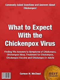 What to Expect With the Chickenpox Virus: Finding The Answers to Symptoms of Chickenpox, Chickenpox Virus, Treatment for Chickenpox, Chickenpox Vaccine and Chickenpox in Adults