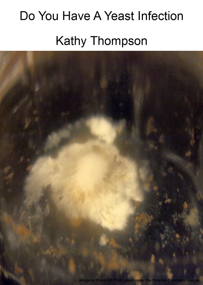 Do You Have A Yeast Infection