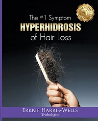 The #1 Symptom of Hair Loss Hyperhidrosis