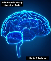 Tales from the Wrong Side of my Brain