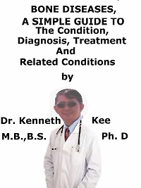 Bone Diseases, A Simple Guide To The Condition, Diagnosis, Treatment And Related Conditions