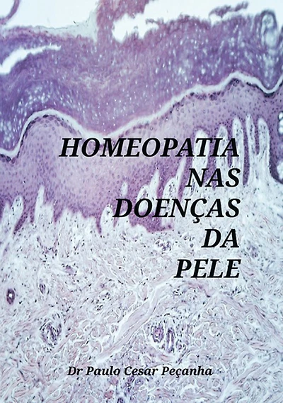 Homeopatia Nas DoenCas Da Pele